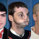 Illustration for article titled The Most Extensive Face Transplant Ever Gives a Man a New Jaw, Teeth, Tongue, Muscle, Tissue, Bone and Skin